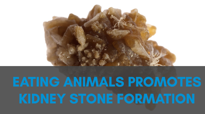 Eating Animal Foods Promotes Kidney Stones.jpg